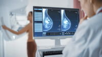 Mammographie mit Brustimplantaten