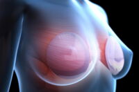 3D-Simulationen können bei der Beratung rund um das Thema Brustvergrößerung zum Einsatz kommen