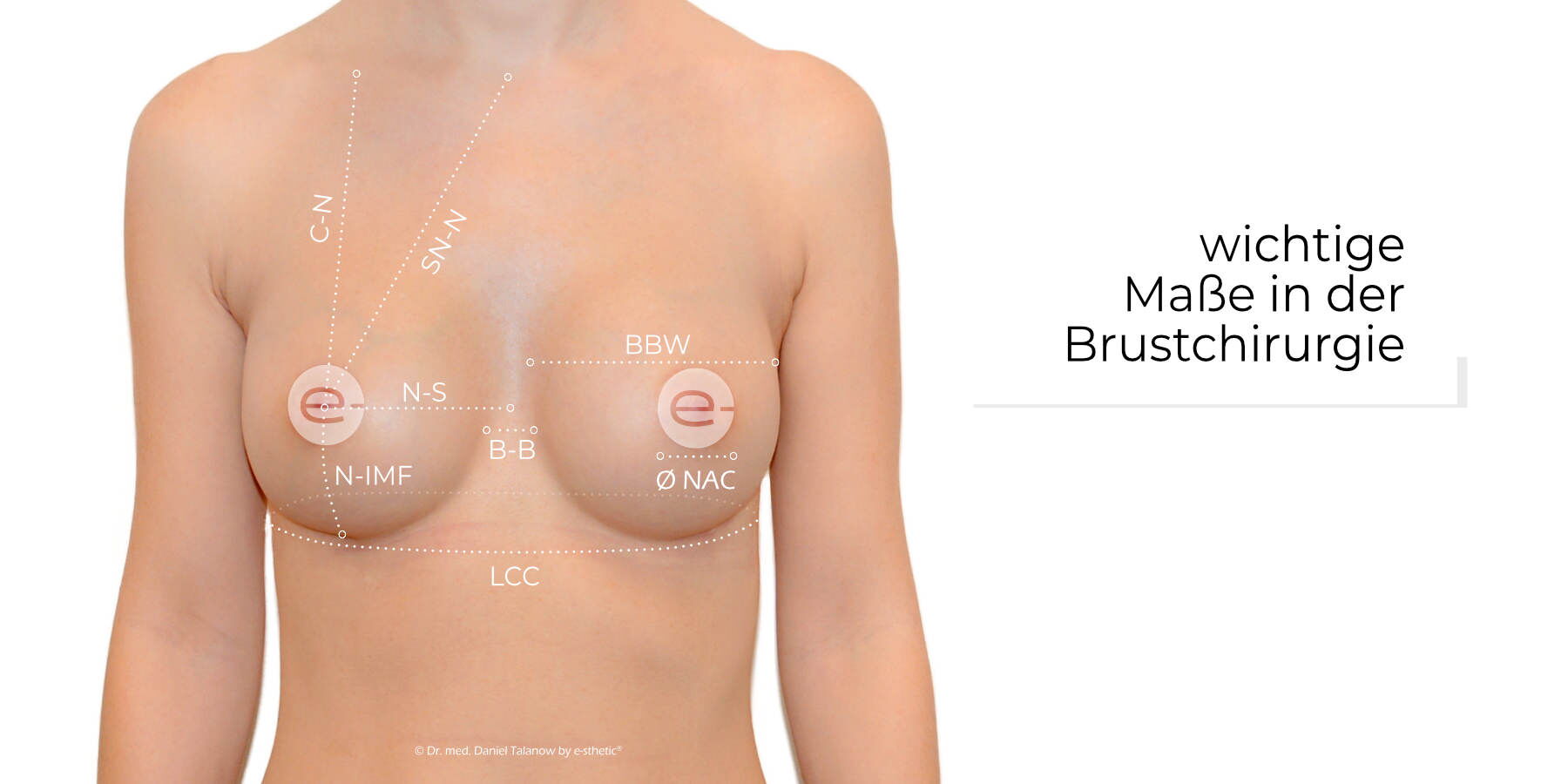 Verschiedene Brustmaße, die entscheidend für die Planung einer Brustoperation sind