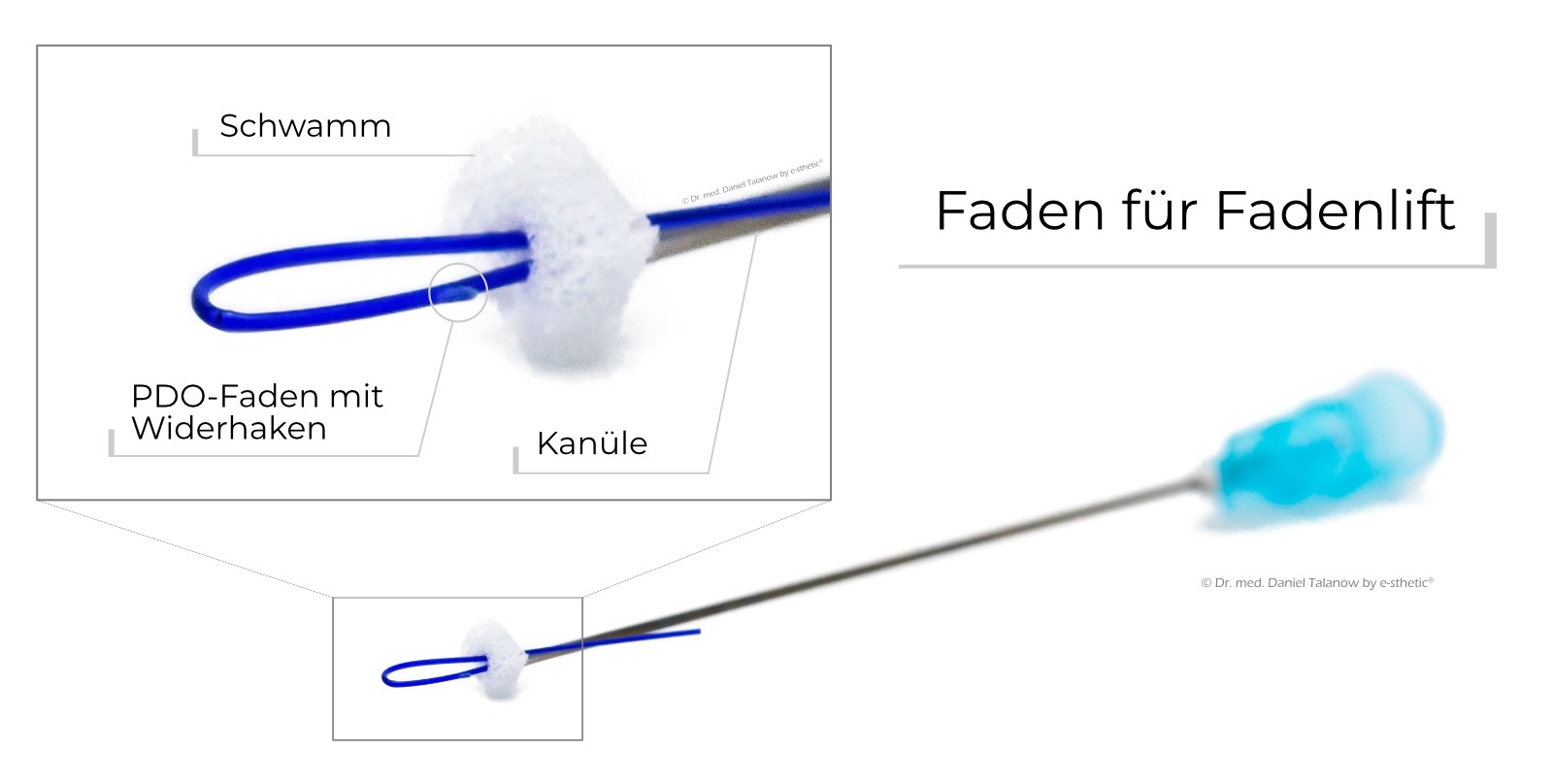 Die PDO-Fäden sind im Einzelfall eine gute Ergänzung zu den klassischen Unterspritzungs-Materialien!